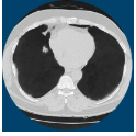 ClearRead Xray